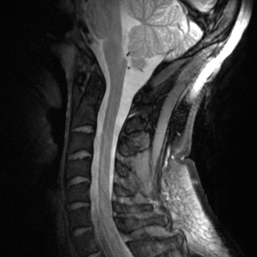 8 Channel Cervical Spine Array for 7 T – RAPID Biomedical